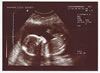 12th scan picture