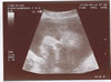 14th scan picture