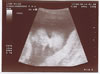 15th scan picture
