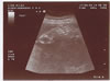 16th scan picture