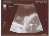 17th scan picture