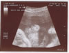 18th scan picture