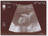 Final scan picture