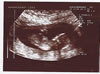 Connall's first picture