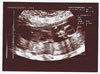 7th scan picture