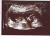 8th scan picture